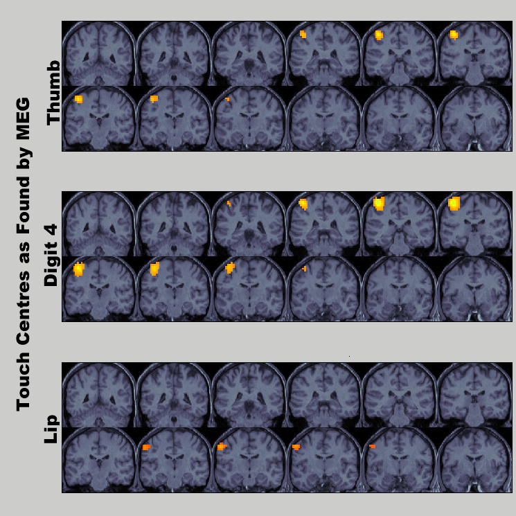 meg imaging